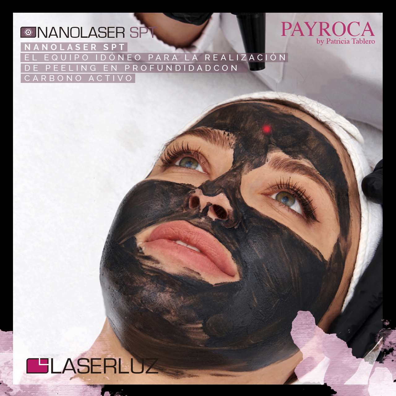 Nanolaser SPT 3 copia